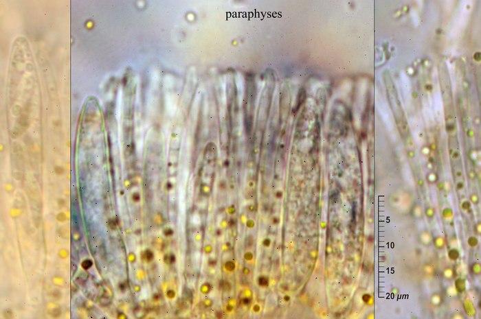 macrostoma