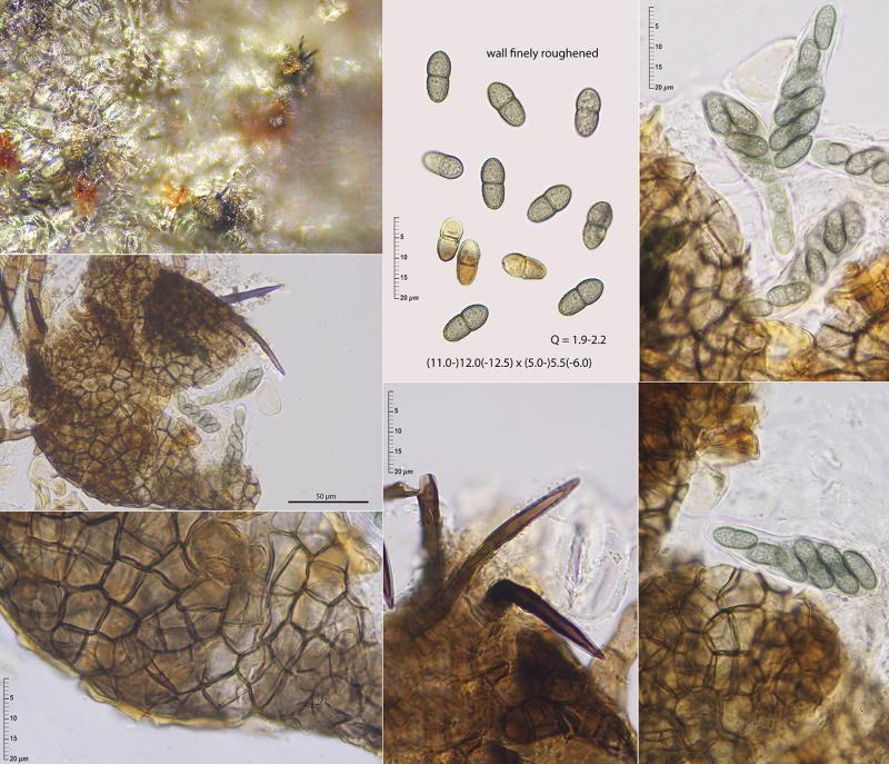 macrostoma