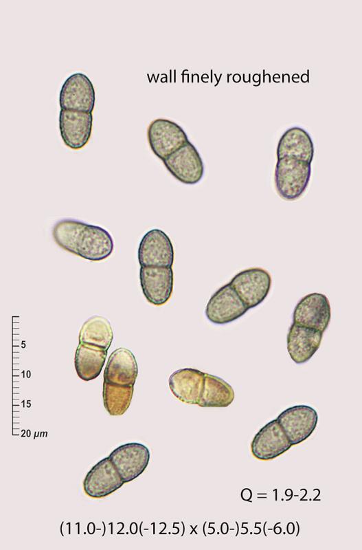 macrostoma