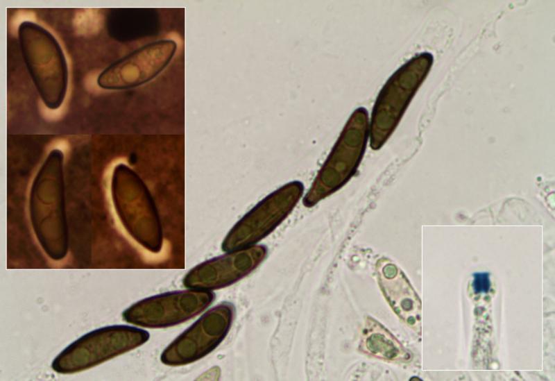 macrostoma