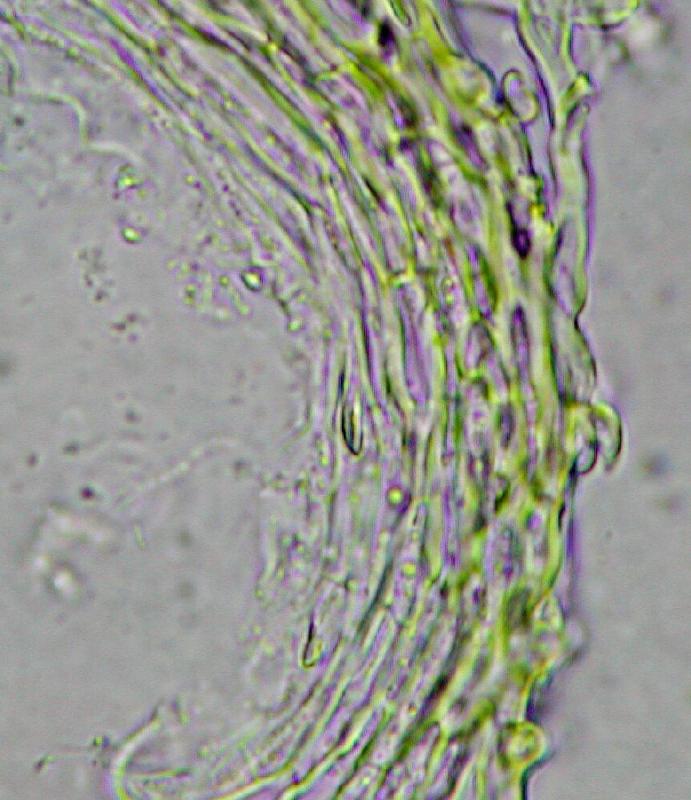 macrostoma