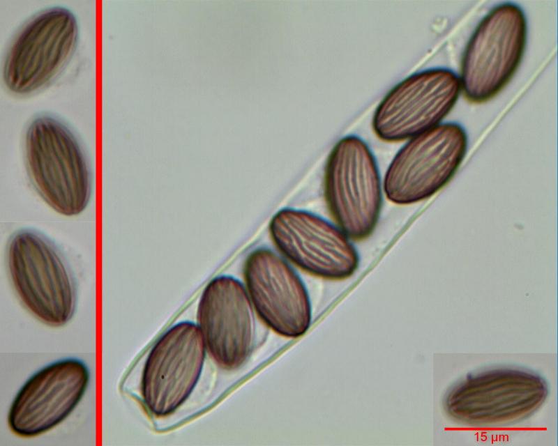 macrostoma