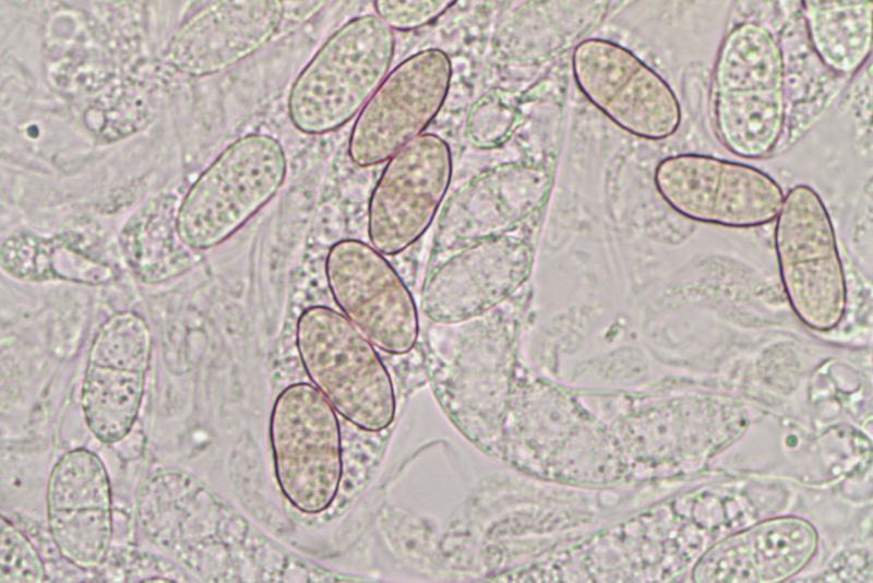 macrostoma