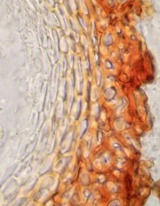 macrostoma