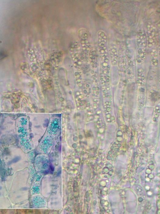 macrostoma