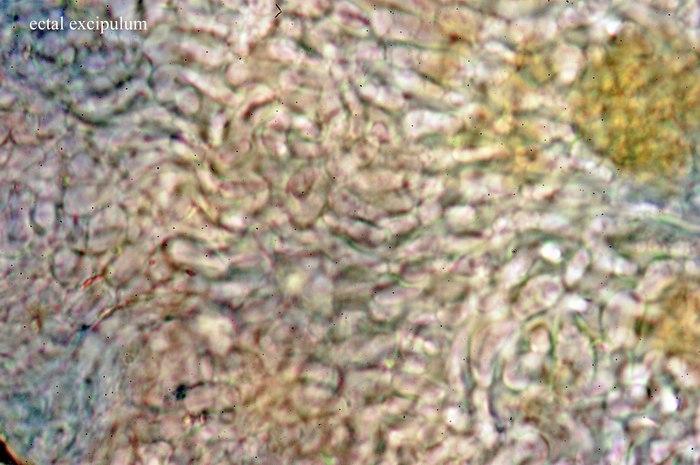 macrostoma