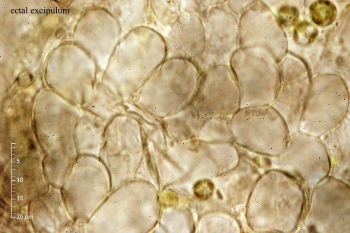 macrostoma
