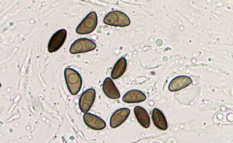 macrostoma