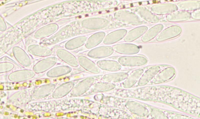 macrostoma