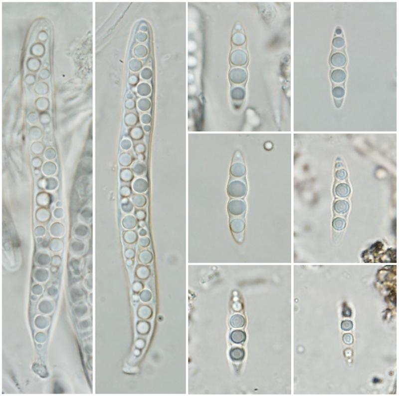 macrostoma