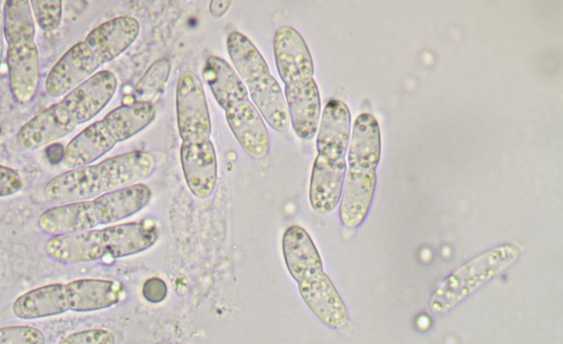 macrostoma