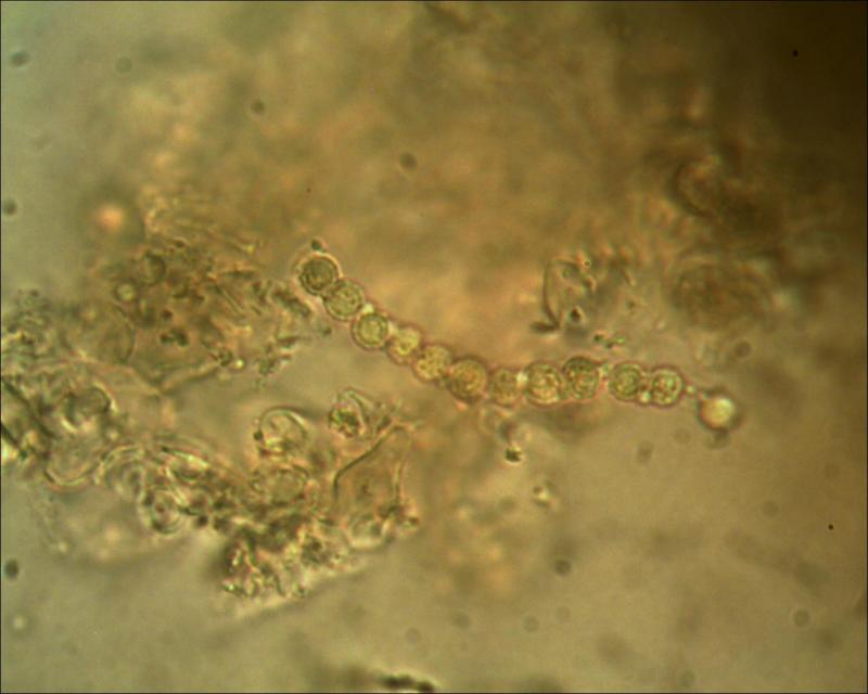 macrostoma