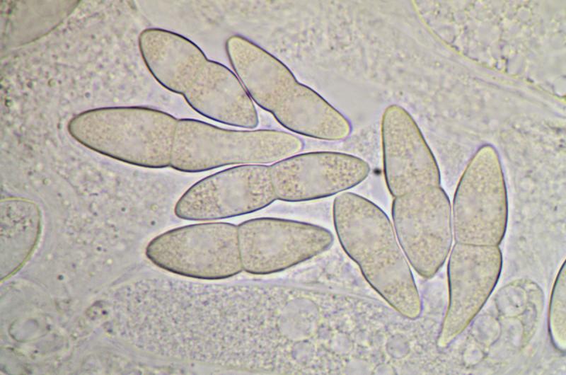 macrostoma