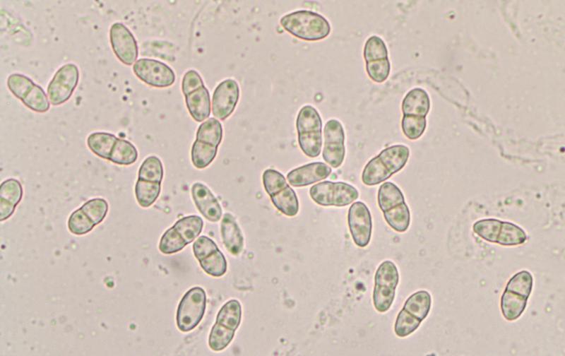 macrostoma