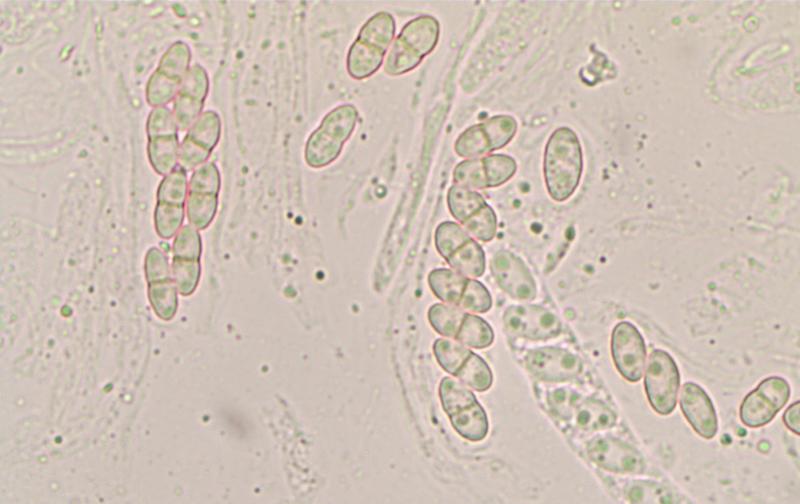 macrostoma