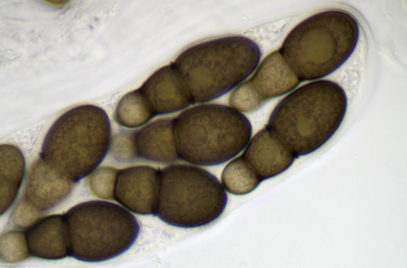 macrostoma