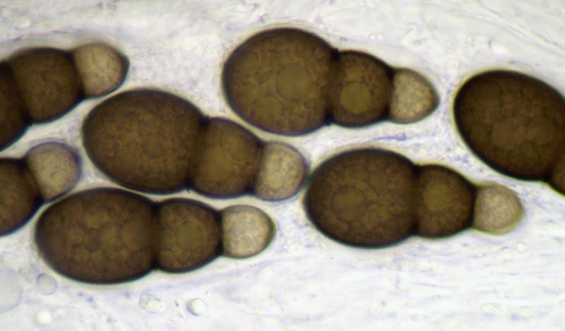 macrostoma