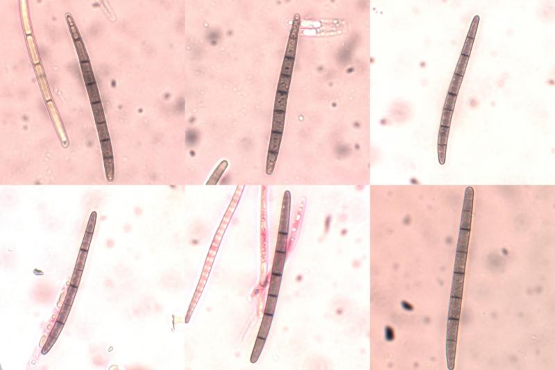 macrostoma