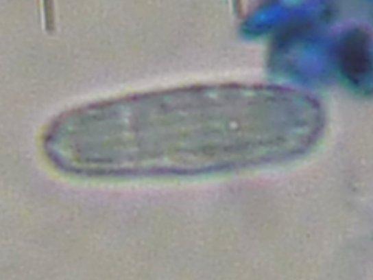 macrostoma