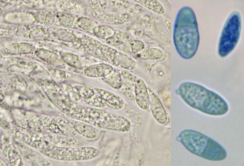 macrostoma